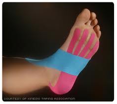 What is Kinesio Tape? — LIGHTHOUSE FOOT & ANKLE CENTER